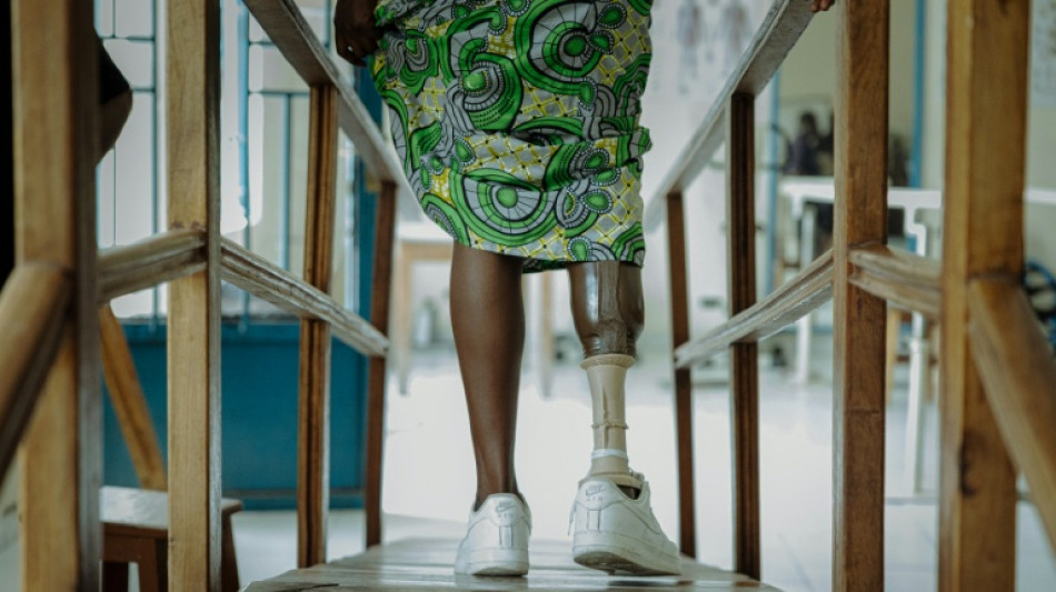DR Congo's amputees bear scars of years of conflict