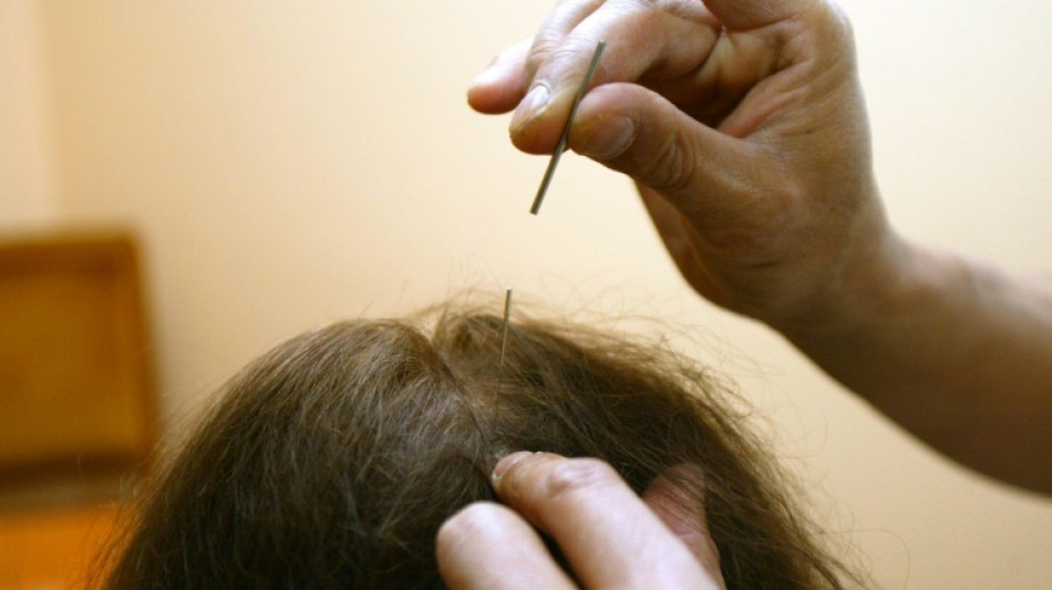 Dans certaines universit&eacute;s, des dipl&ocirc;mes de m&eacute;decines alternatives qui "posent probl&egrave;me"