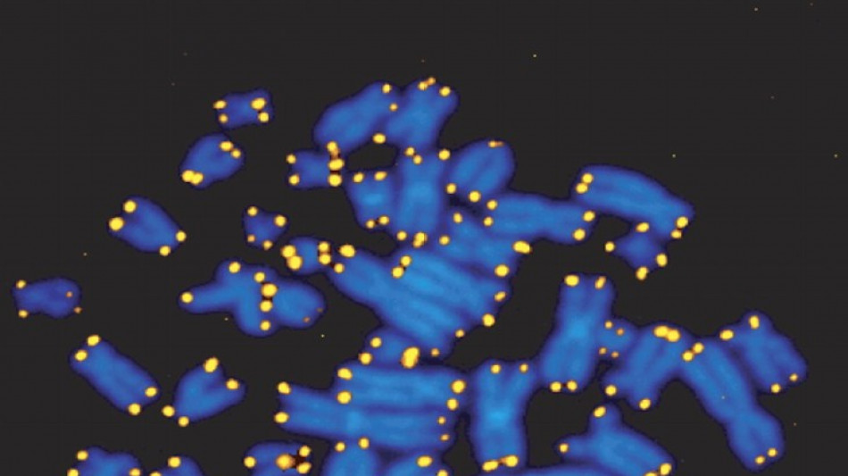 L'invecchiamento del Dna alla base dell'Alzheimer, lo studio italiano